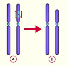 -prstenasti kromosom [r]: dijelovi kromosoma
