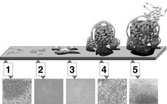 5: Фази на прицврстување на бактериите за подлогата Во устата се присутни различни површини за кои можат да бидат прицврстени бактериите.