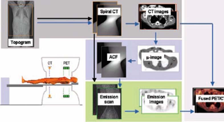 PET/CT Το 2001 εισάγεται στην κλινική πράξη η υβριδική-fusion τεχνική, η ποζιτρονική υπολογιστική τομογραφία, PET/CT Πραγματοποιεί τις δύο μελέτες σε μια εξέταση, προσφέροντας ανατομικές και