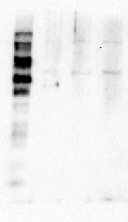 4.2 ΑΝΟΣΟΑΠΟΤΥΠΩΣΗ, (WESTERN BLOTTING) PARN wt Mock PARN (1-523) PM Επιπλέον, μετά από τις υπερεκφράσεις του μεταλλάγματος PARN(1-523) στα καρκινικά κύτταρα και την απομόνωση RNA και πρωτεινών από