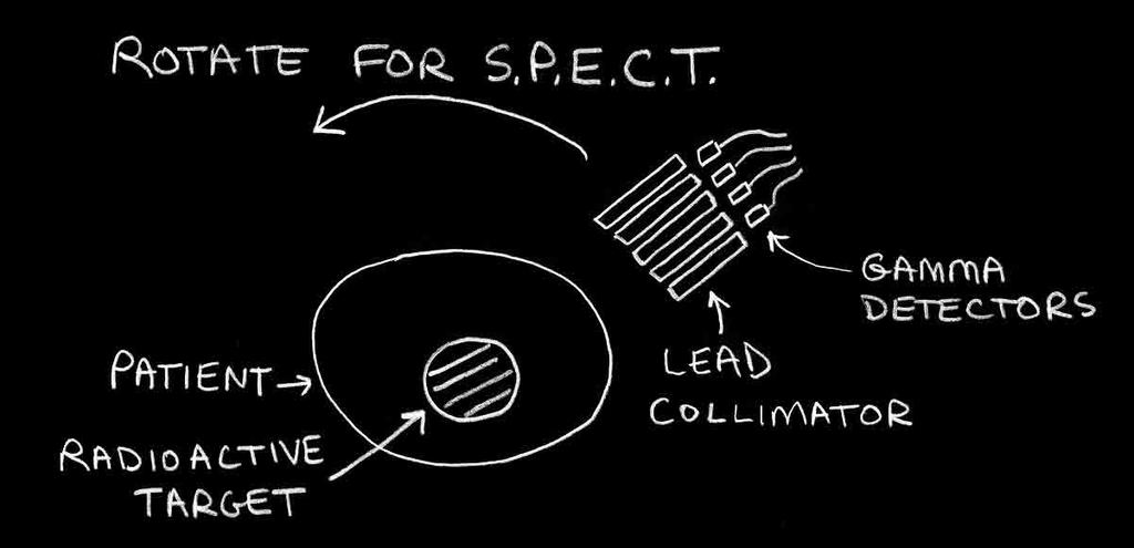 SPECT Single Photon Emission Computed Tomography Υπολογιστική τοµογραφία µονοφωτονιακής εκποµπής Gamma camera