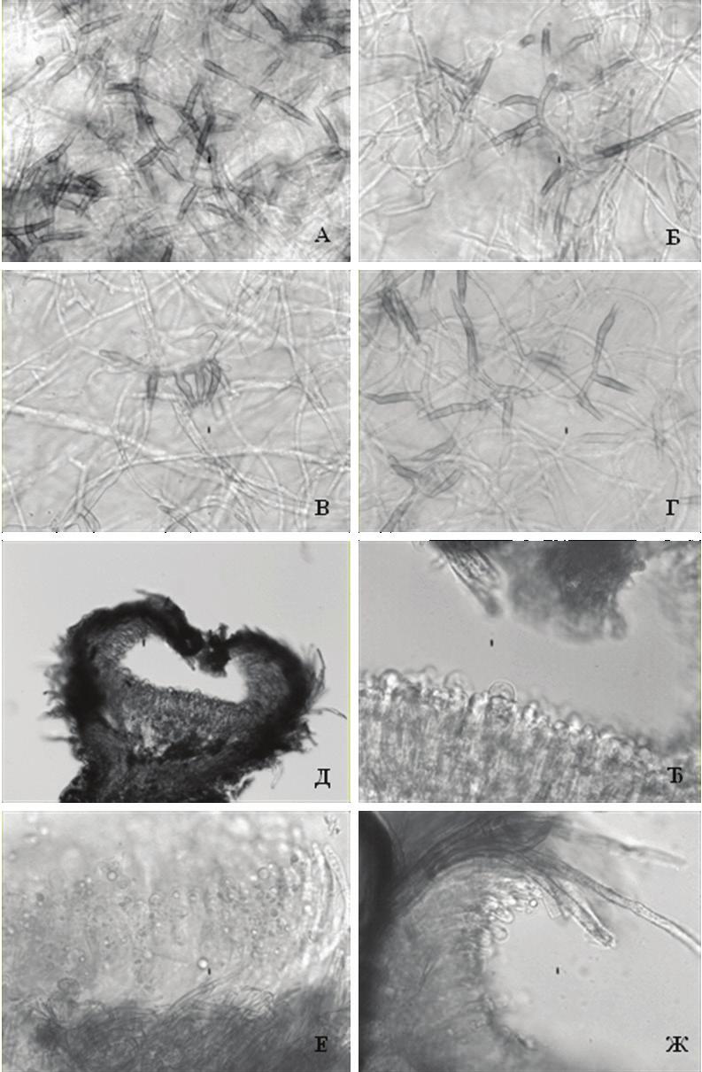 Слика 3. Hymenoscyphus fraxineus: А-Б-В-Г - фиалиде образоване у култури (x400); Д - пресек кроз апотецију (x100); Ђ-Е-Ж - аскуси са аскоспорама Figure 3.