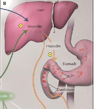 hepcidin από το ήπαρ και αναστέλλουν την