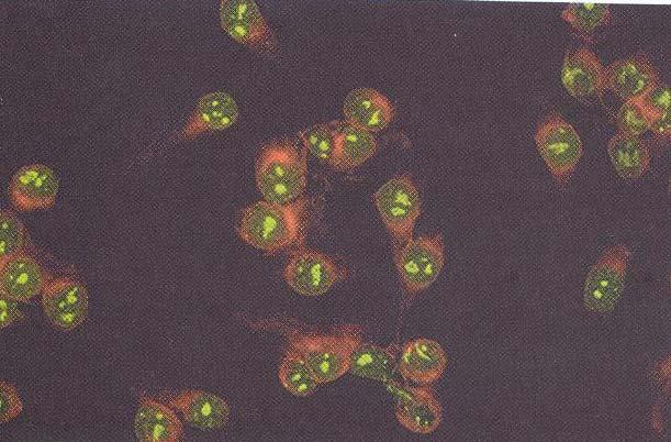 ΑNA -Πυρηνισκικός φθορισμός (κύτταρα HEp2) (παρατηρούνται περί τα