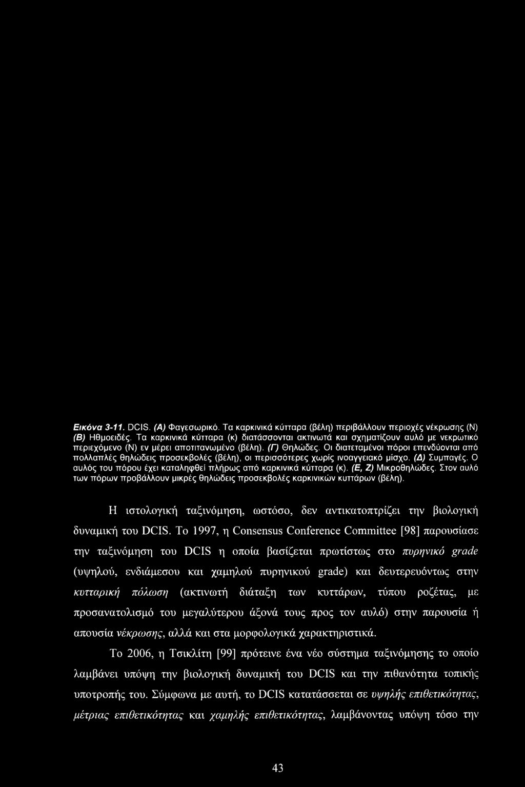 Το 1997, η Consensus Conference Committee [98] παρουσίασε την ταξινόμηση του DCIS η οποία βασίζεται πρωτίστως στο πυρηνικό grade (υψηλού, ενδιάμεσου και χαμηλού πυρηνικού grade) και δευτερευόντως