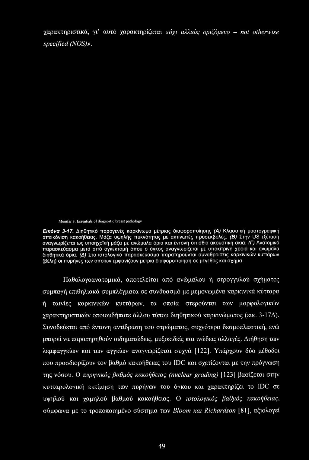 (Β) Στην US εξέταση αναγνωρίζεται ως υποηχοϊκή μάζα με ανώμαλα όρια και έντονη οπίσθια ακουστική σκιά.