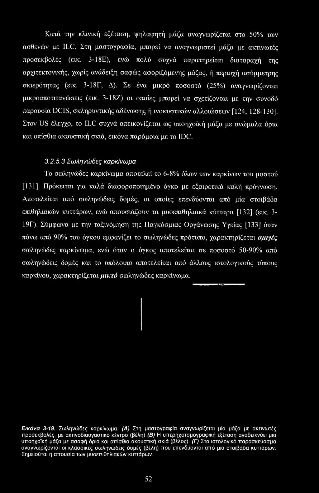 3 Σωληνώδες καρκίνωμα Το σωληνώδες καρκίνωμα αποτελεί το 6-8% όλων των καρκίνων του μαστού [131]. Πρόκειται για καλά διαφοροποιημένο όγκο με εξαιρετικά καλή πρόγνωση.