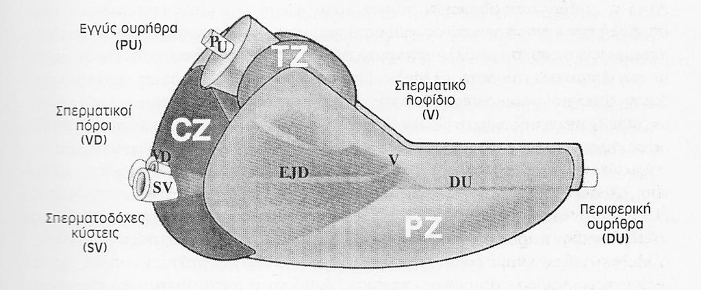 νεοπλασματικής εστίας. Ο καρκίνος του προστάτη επεκτείνεται δια διηθήσεως και δεν προκαλεί αντιδραστικό ιστό[122]. Για παράδειγμα, η βλάβη είναι υπόηχη αν η νεοπλασματική μεγέθυνση είναι στέρεα μάζα.