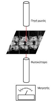 5.2.5 Πυκνομετρία (densitometry) Η πυκνομετρία αποτελεί μία από τις μεθόδους για την ποσοτική εκτίμηση των συστατικών της ηλεκτροφορητικής τεχνικής (Σχήμα 5.3).