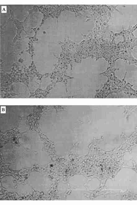 48 18 Fig 6 Enzyme activity staining for human embryonic kidney cells (A) Before transfection (B) After transfection 3, AChE [14 ],, AChE [8 ] AChE AChE, AChE [2 ] rhache,,,, 293 AChE HeLa AChE, (
