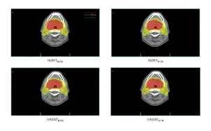 και VMAT που χρησιμοποιήθηκαν, αντίστοιχα για ραδιοβιολογικές και