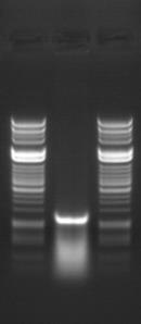 5 RNAi (RNA interference) γηα ηελ απνζηώπεζε ηνπ γνληδίνπ lef8 Ζ απμζζχπδζδ ιέζς RNAi εθανιυζηδηε ςξ εκαθθαηηζηυξ ηνυπμξ αθαίνεζδξ ηδξ πνςηεΐκδξ LEF8, πμο ααζίγεηαζ ζηδκ ηαηαζηνμθή ηςκ ιεηαβνάθςκ ημο