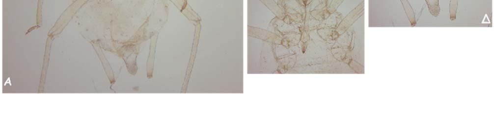 πραγματοποιήθηκε από τον Δρ. κ. Ιωάννη Μαργαριτόπουλο. Εικόνα 4.2. Ενήλικο άπτερο του είδους M. Persicae σε μόνιμο παρασκεύασμα (slide) (Α).