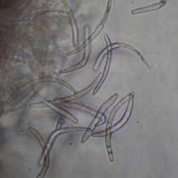 52 : Κονίδια του Phloeosporella padi Το χειμώνα σχηματίζονται τα αποθήκια (και στις δύο πλευρές των