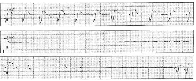 Int J Cardiol