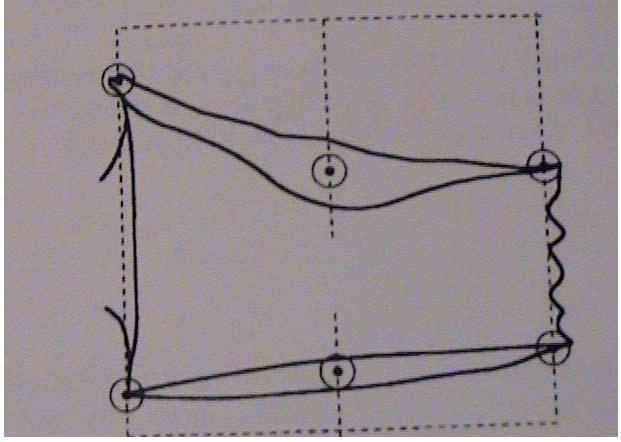 επικέντρωση τον Ο3 οσφυϊκό σπόνδυλο. Η μέθοδος της μορφοποίησης γίνεται με μέτρηση του πρόσθιου (Ηπ) μέσου (Ημ) και οπίσθιου ύψους(ηο) κάθε σπονδυλικού σώματος από τον Θ4 έως τον Ο4 σπόνδυλο.