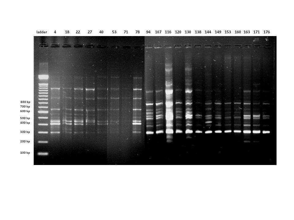 10.5. Αποτελέσµατα ERIC 2 PCR Από τη σύγκριση των αποτελεσµάτων των ηλεκτροφόρησεων της ERIC 2 PCR (Εικόνα 31) µεταξύ 21 στελεχών που παρήγαγαν VIM-2 καρµπαπενεµάση προέκυψαν 7 διαφορετικά προφίλ