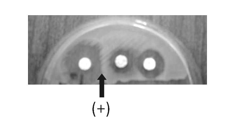 Εικόνα 8. Σχηµατική αναπαράσταση διενέργειας του D-test (Οµιλία: Μελέτης Γ. «Μηχανισµοί αντοχής της P.
