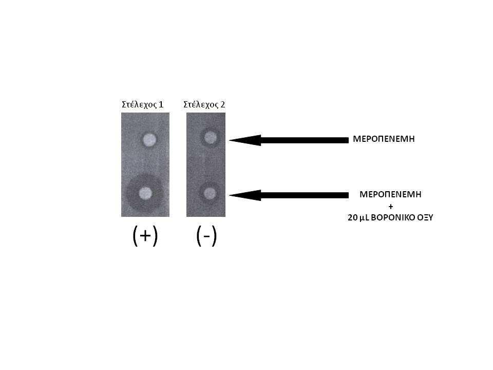 Μικροβιολογίας και Βιοχηµείας). Εικόνα 11. Αποτελέσµατα boronic acid test. (+): Θετικό, (-): Αρνητικό (Οµιλία: Μελέτης Γ.