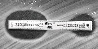 Εικόνα 17. Θετικό E-test MBL (Πηγή: http://jcm.asm.org/content/40/8/2755/f1.large. jpg).