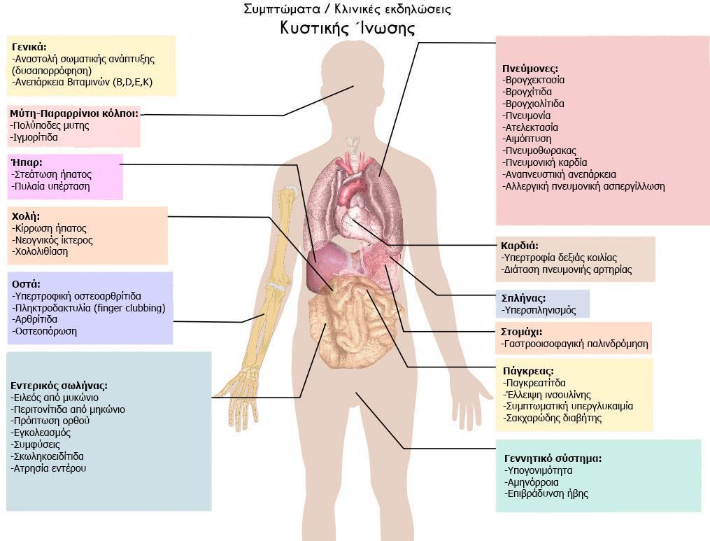 Πηγή: https://commons.wikimedia.org/wiki/file:cystic_fibrosis_manifestations.svg [18]. Γενικά, υπάρχει μεγάλη ποικιλία στην εμφάνιση αλλά και τη βαρύτητα των εκδηλώσεων της ασθένειας.