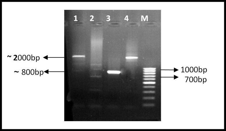 Εικόνα 7. Ηλεκτροφόρηση σε πήκτωμα αγαρόζης 1%w/v της γονιδιακής αναδιάταξης των εξονίων 23 και 24 με διαγνωστικούς εκκινητές. Στη θέση 1 φαίνεται ο δείκτης μοριακών μαζών (DNA ladder).