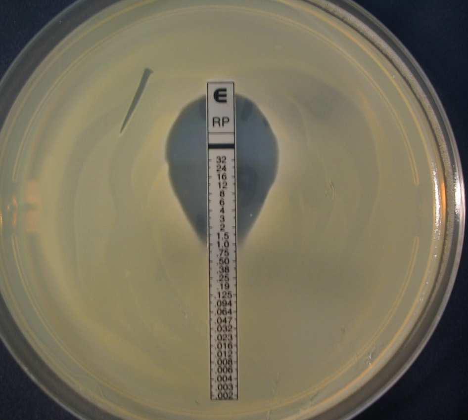 Εικόνα 2: Ε-test κινοπριστίνης/νταλφοπριστίνης σε στέλεχος σταφυλόκοκκου. MIC=1 µg/ml. 4.