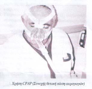 Ενθαρρύνεται να ελέγχει την αναπνοή του, κρατώντας την εισπνοή του για τρία τουλάχιστον λεπτά, εκπτύσσοντας το θώρακα στο κατώτερο τμήμα άμφω και προοδευτικά δίνοντας έμφαση στη χειρουργημένη πλευρά,