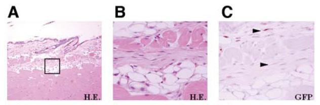 φθορίζουσα µικροσκοπία, τα EGFP+ κύτταρα ήταν ορατά στο υπό επούλωση χόριο την 14η (C) και 21η (D) ηµέρα µετά τον τραυµατισµό.
