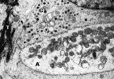 Εικόνα 1.5. Κοκκία του Birbeck εντός του κυτταροπλάσµατος ενός επιδερµιδικού κυττάρου του Langerhans. m: µιτοχόνδριο) [Kanitakis 2002].