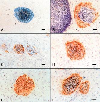 για αναγνώριση των hes cells είναι τα γλυκολιπίδια SSEA3 και SSEA4 και οι πρωτεογλυκάνες Tra-1-60 και Tra-1-81 [Adewumi et al., 2007].