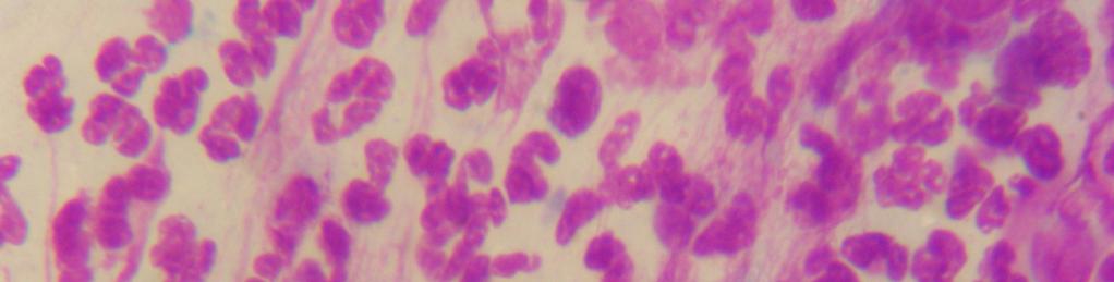 специјалних катетера CytoBact-NIV-NS Цито-морфолошки размаз ексфолијата слузокоже