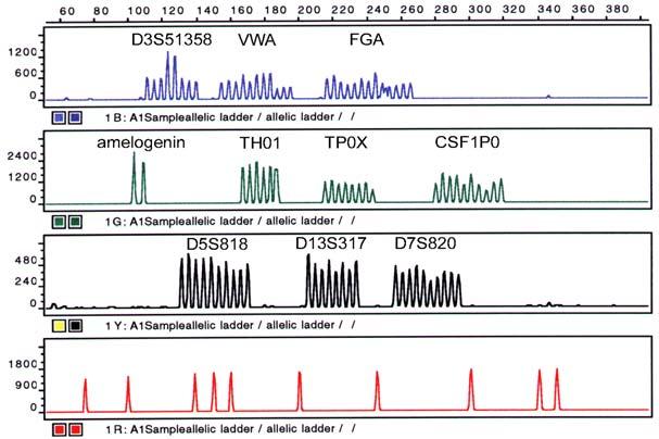 PRIMJER MULTIPLEX- PCR ANALIZE. Slika 12. Primjer multiplex (višestrukog) PCR-a.
