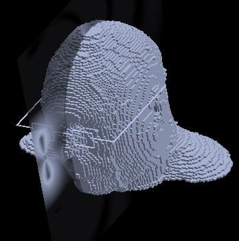 Εικόνα 5.23 3D Απεικόνιση της 4ης απόστασης χρησιμοποιώντας το μεταλλικό σκελετό γυαλιών Εικόνα 5.
