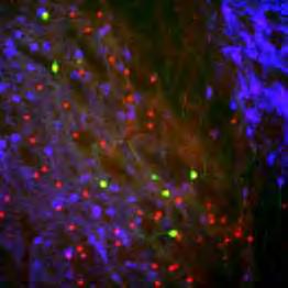 Α) Φωτoγραφία με φακό 20x από τομή ζώου Adora2a-Cre όπου διακρίνονται τα κύτταρα που έχει μολύνει