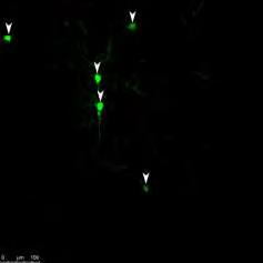 Στις δύο φωτογραφίες πάνω, τα λευκά βελάκια υποδεικνύουν τα κύτταρα του ιού της λύσσας.