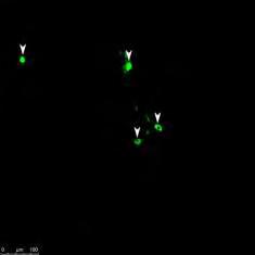 1-PV Rb-PV Sum of Prototypic Εικόνα 16: (A) Χρώσεις της εξωτερικής μοίρας της ωχράς σφαίρας από μικροσκόπιο