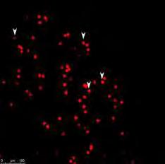 Στις δύο φωτογραφίες πάνω, τα λευκά βελάκια υποδεικνύουν τα κύτταρα του ιού της λύσσας.