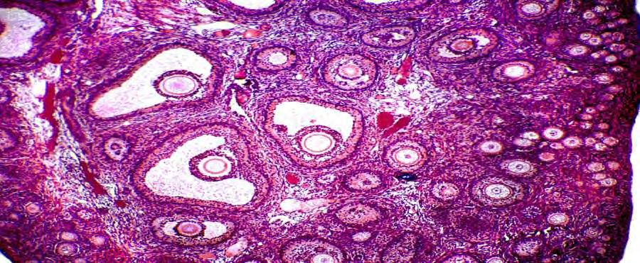 Α) ΘΕΩΡΗΤΙΚΟ ΜΕΡΟΣ Follicles in a human ovary,
