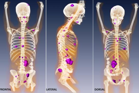 νέας γενιάς (PET/CT/MR imaging) Βιοπληροφορική, υπολογιστικές