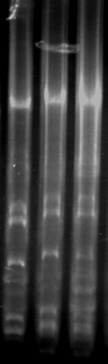 Τα στελέχη Α1, Α2, Α3, Α4, Α5, Α6, Α7, Α8, Α9 και Α10 παρουσίασαν το ίδιο πλασμιδιακό προφίλ από τα οποία τα Α1 και Α2 καθώς και τα Α4 και Α5 είναι απομονώσεις του ίδιου στελέχους σύμφωνα με την