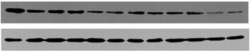 Izbira RNAi proti mutiranemu ataxin-1 F7 F1 F5 F2 F10 CAG F11 F3 F8 F9 F6 CAG