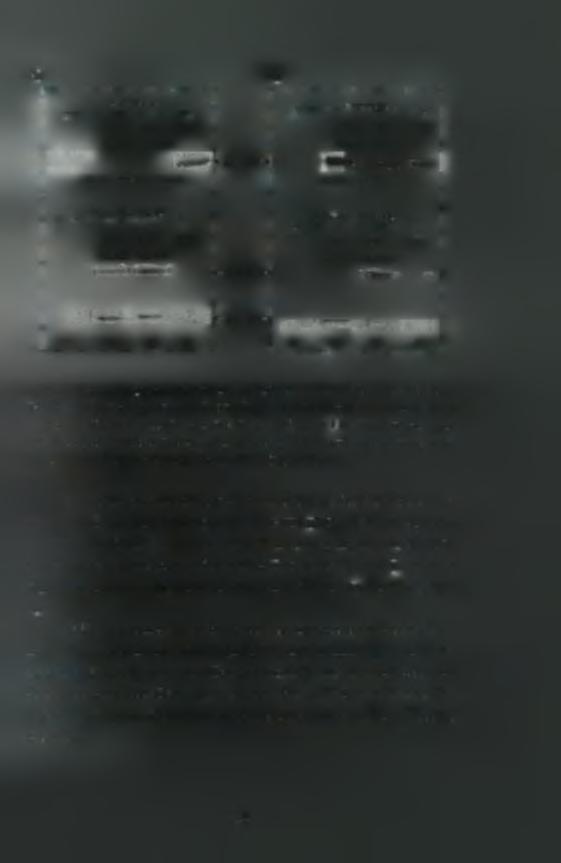 A) B) FLAG- SRPK1 FLAG- SRPKIa ι------------------------------------------------------------- 1 1 1 GFP GFP GFP GFP GFP GFP SAFB1 SAFB2 SAFB1 SAFB2.