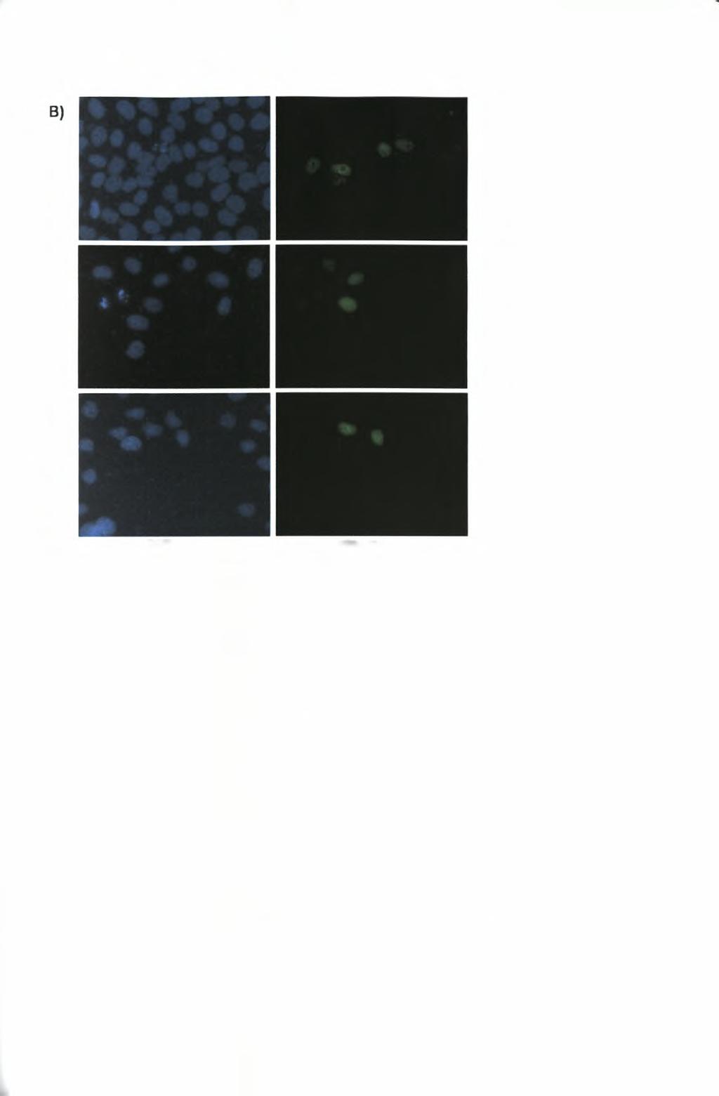 GFP-SAFB2/ FLAG a GFP-SAFB2/ FLAG-SRPKIa b GFP-SAFB2/ FLAG-SRPK1 C DAPI φθορισμός Εικόνα 48: Υποκυτταρικός εντοπισμός των παραγόντων SAFB1 και SAFB2 μέσω