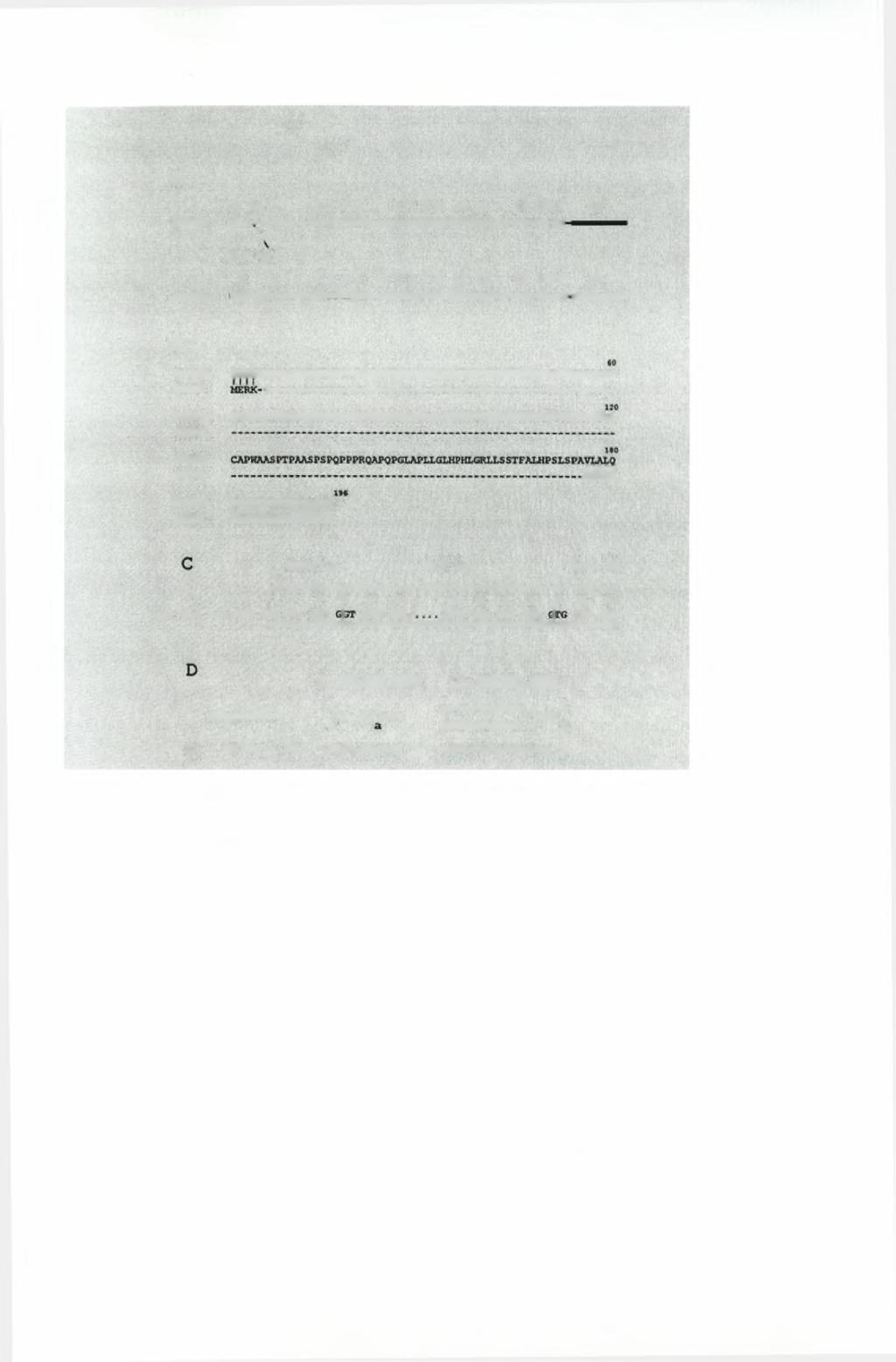 A SRPK1 SRPKIa 1* lb F\ 513 bp 1 2345 6789 10 11 12 1314 15 2345 6 7 8 9 10 11 12 1314 15 B SRPKIa SRPKJ SRPKIa SRFKl SRPKt* sxha SRPK1* sum HF.RKKEKWSGUUIEGOWS Pa?0FWjjRi 