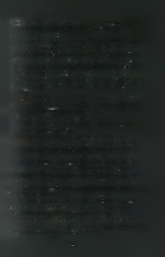 Virus) με την SRPK1 έχει ως αποτέλεσμα την ανώμαλη φωσφορυλίωση των παραγόντων ματίσματος και την ανικανότητα δημιουργίας λειτουργικού συμπλόκου ματίσματος (Sciabica et al, 2003).