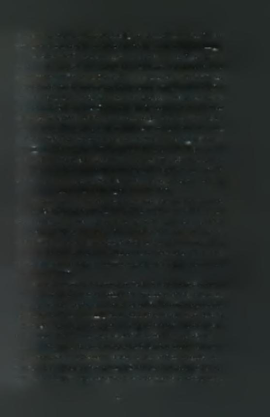 οιστρογόνα (estrogen response elements-ere) και μετά από 13 νουκλεοτίδια ένα πλαίσιο ΤΑΤΑ, όπου θεωρείται ότι προσδένεται ο SAFB1 (Oesterreich et αί, 1997).