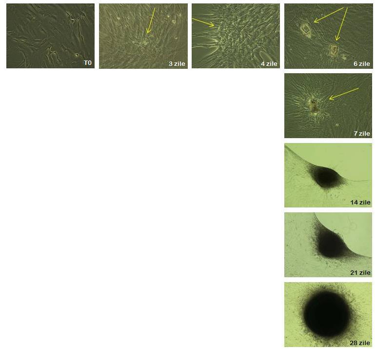 Fig.3- Micrografii reprezentand evolutia celulelor ADAS cultivate in sistem 2D in prezenta MD2 timp de 28 de zile. Sagetile indica centrii de condensare celulara specifici condrogenezei timpurii.
