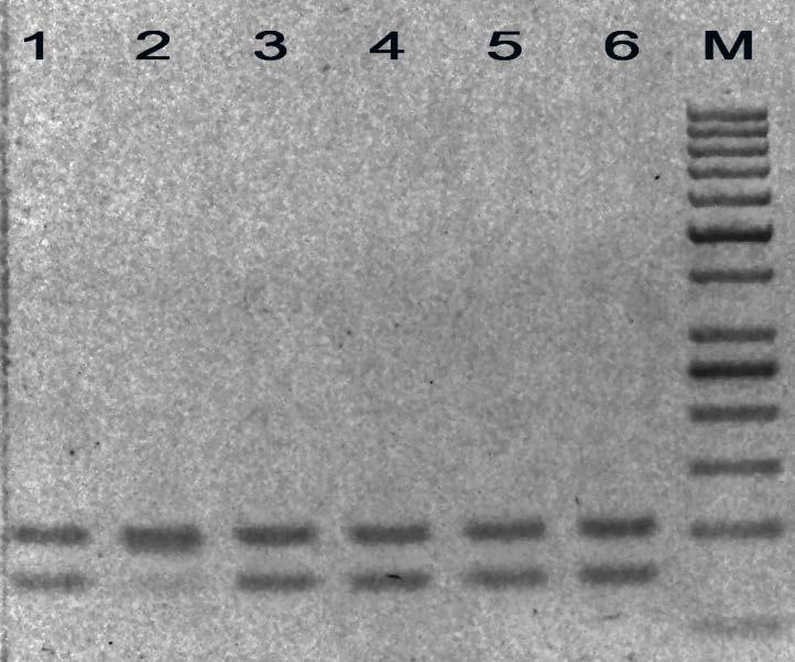 Слика 3: Пример резултата генотипизације CYP3A5*3 (6986A>G, rs776746) 74bp 102b