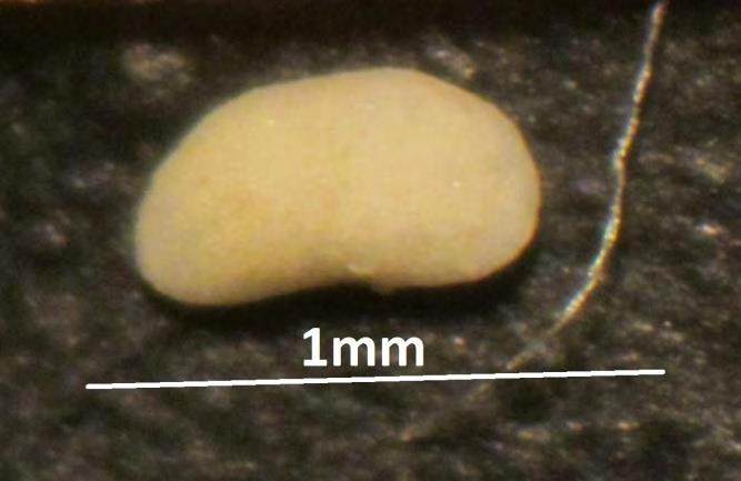 Eχει βρεθεί στα Μελίσσια (Κόρινθος) Ραχιαία πλευρά Οπίσθια πλευρά Εμπρόσθια πλευρά Κοιλιακή πλευρά Φωτογραφία δεξιάς θυρίδας από Amplocypris sinuosa, κόσκινου 4Φ και